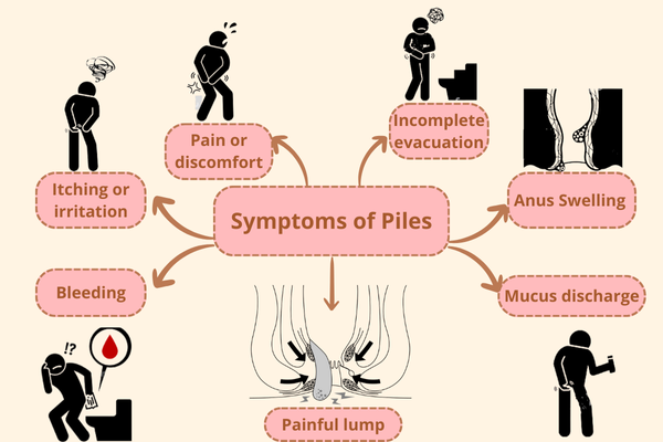 Piles Laser Treatment in Bibwewadi, Pune by Dr. Rutik Gandhi