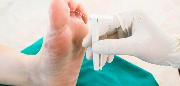 Diabetic Foot Management Treatment in Bibwewadi, Pune by Dr. Rutik Gandhi