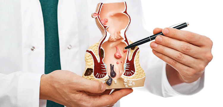 Fistula Treatment in Bibwewadi, Pune by Dr. Rutik Gandhi